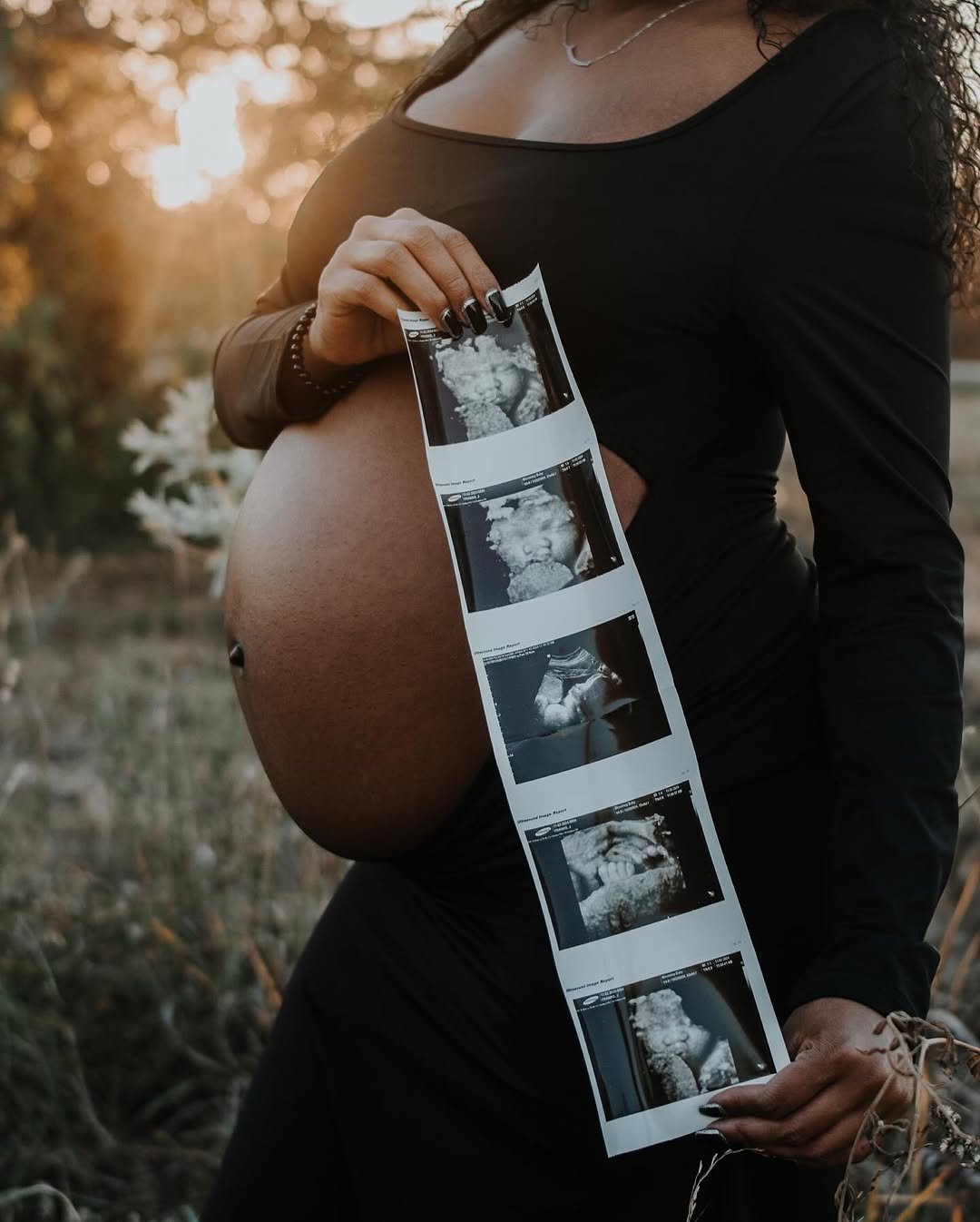 maternity